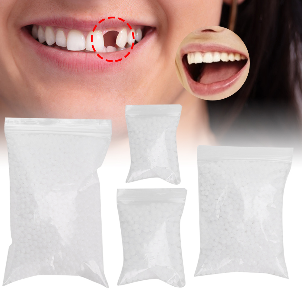 Teeth Whitening Moulds - Tandreparatiekraal Gebroken tanden Reparatie Tijdelijke tandreparatiekralen