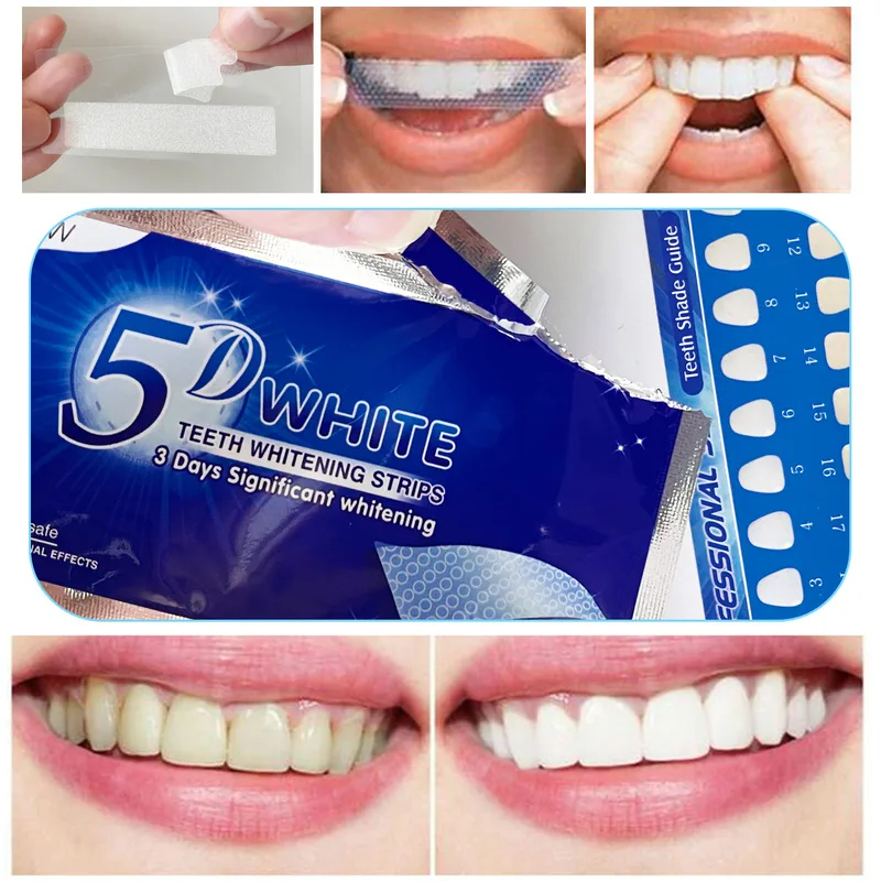 Teeth Whitening Results - 1-12 Stuks 5D Whitening Tanden Stickers