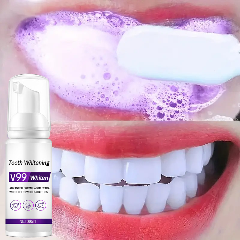 Mousse V99 Tandpasta Tandenrei - Teeth Whitening Mousse recensie en prijs