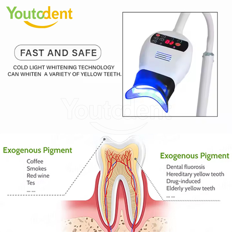 Professionele Tandheelkundige  - Teeth Whitening Express recensie en prijs