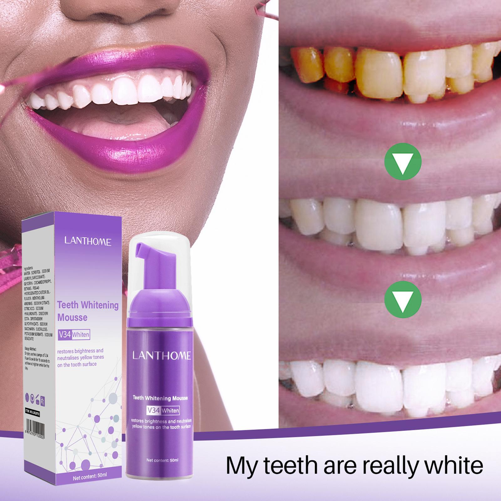 50MLTanden Whitening Mousse Ve - Teeth Whitening Mousse recensie en prijs