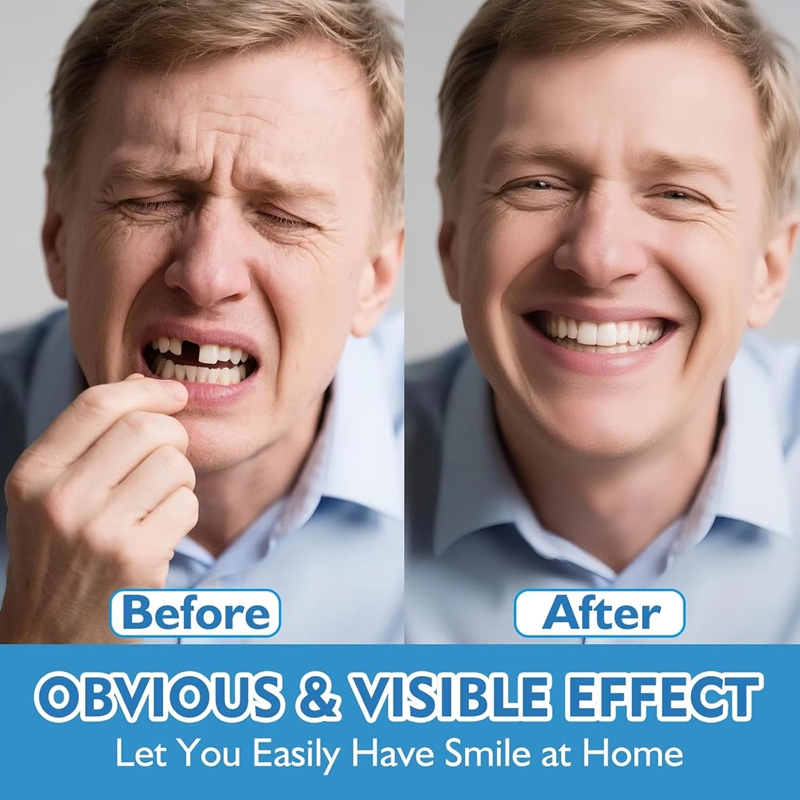 Volledige set siliconen gebits - Teeth Whitening Moulds recensie en prijs