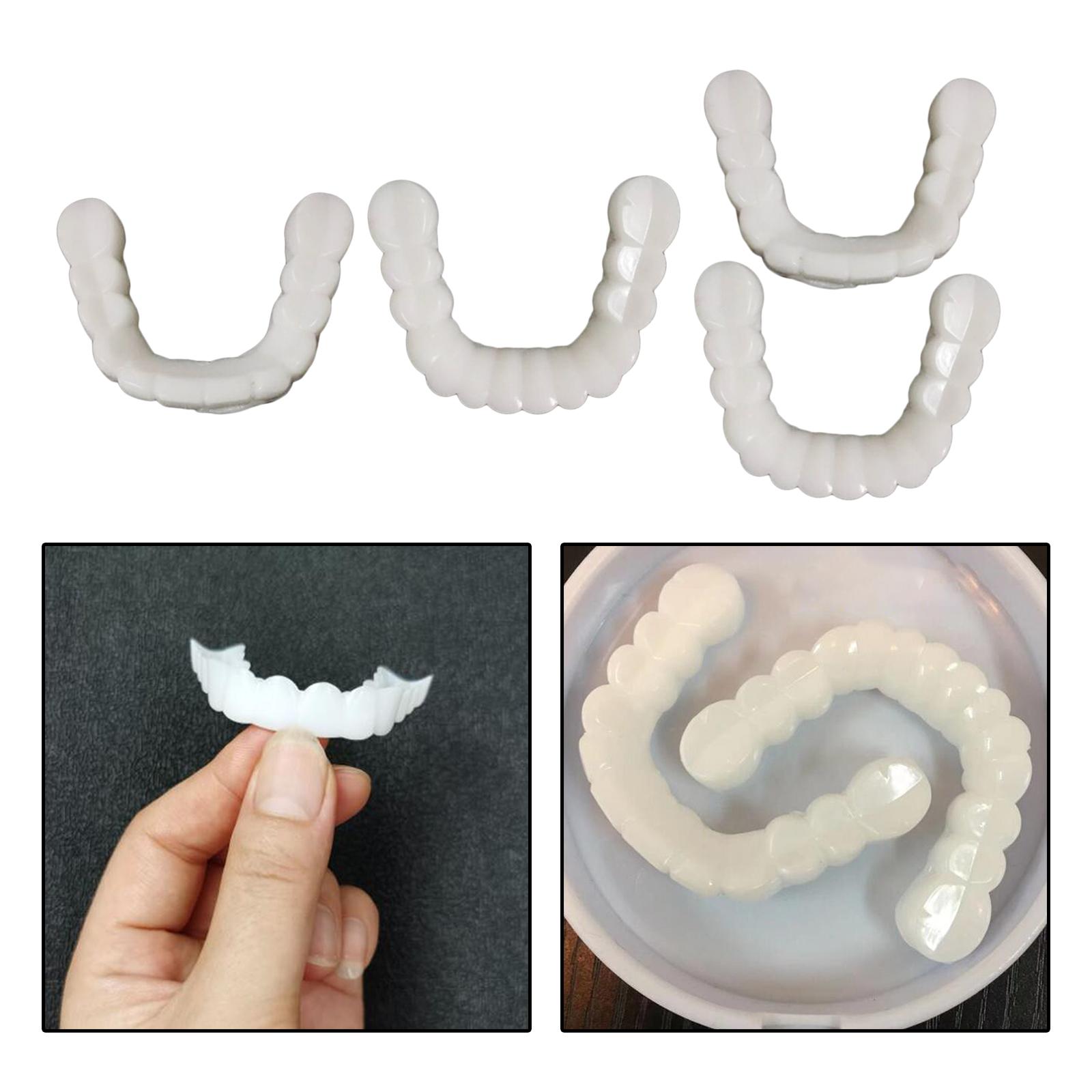 Fake Tooth Cover Tandenbleekhu - Teeth Whitening Moulds recensie en prijs