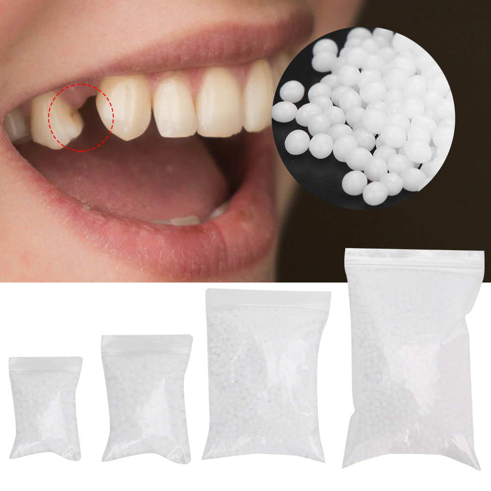 Tandreparatiekraal Gebroken ta - Teeth Whitening Moulds recensie en prijs