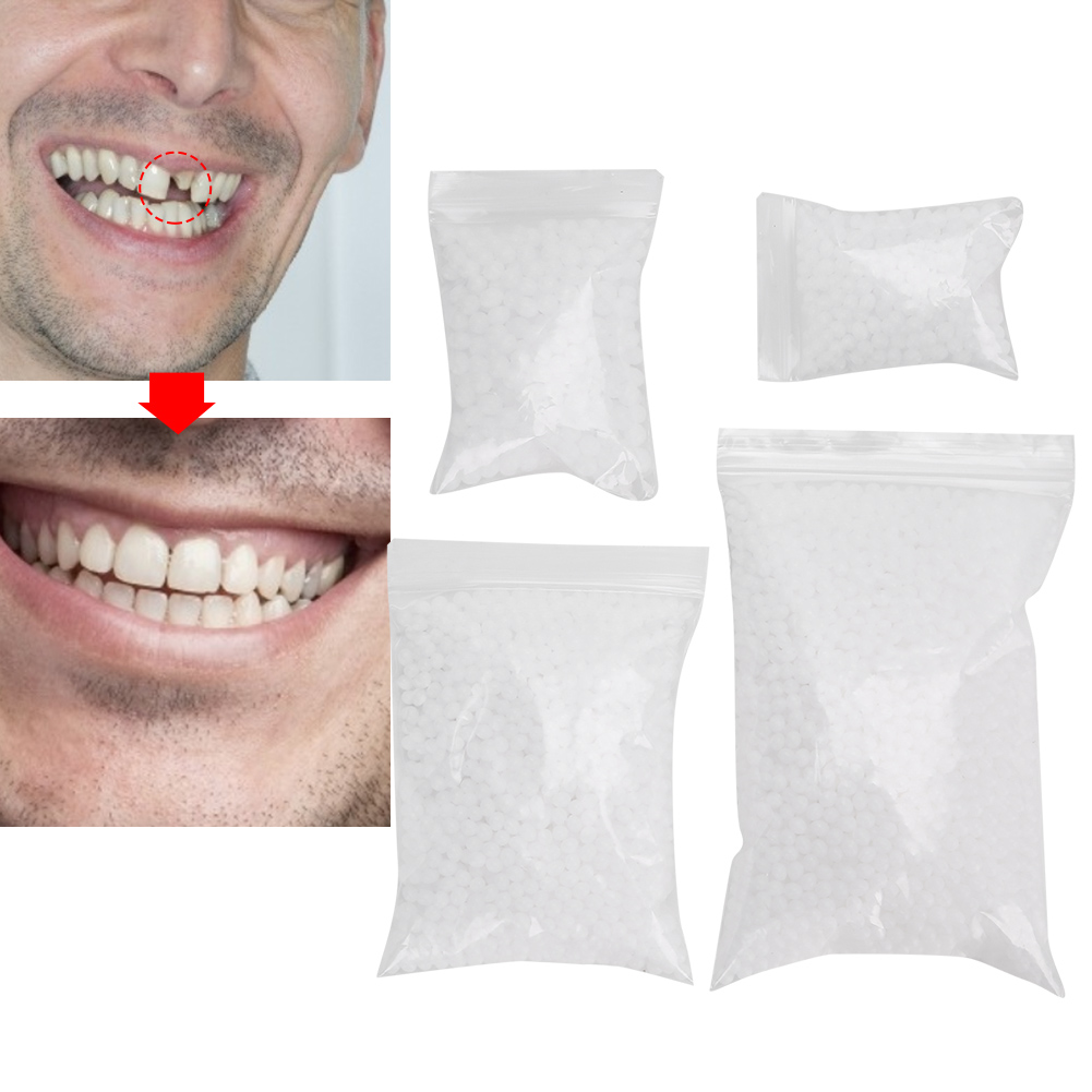 Tandreparatiekraal Gebroken ta - Teeth Whitening Moulds recensie en prijs
