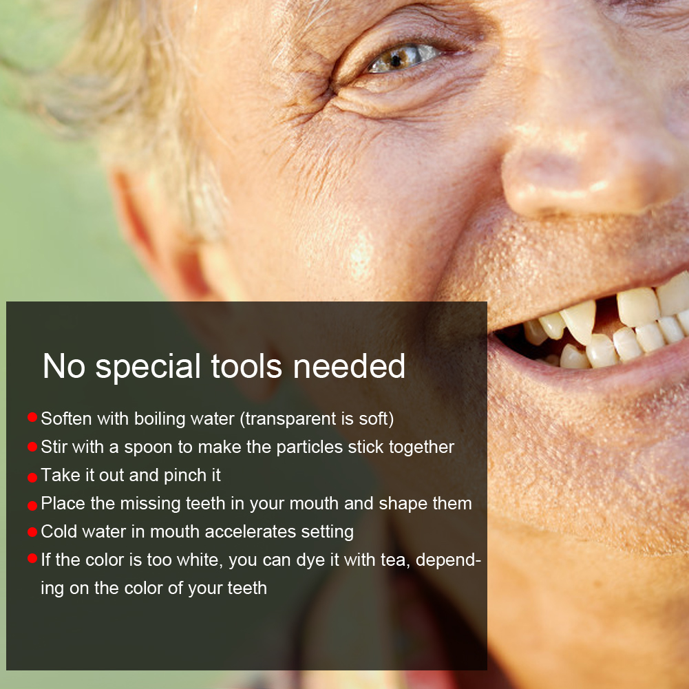 Tandreparatiekraal Gebroken ta - Teeth Whitening Moulds recensie en prijs