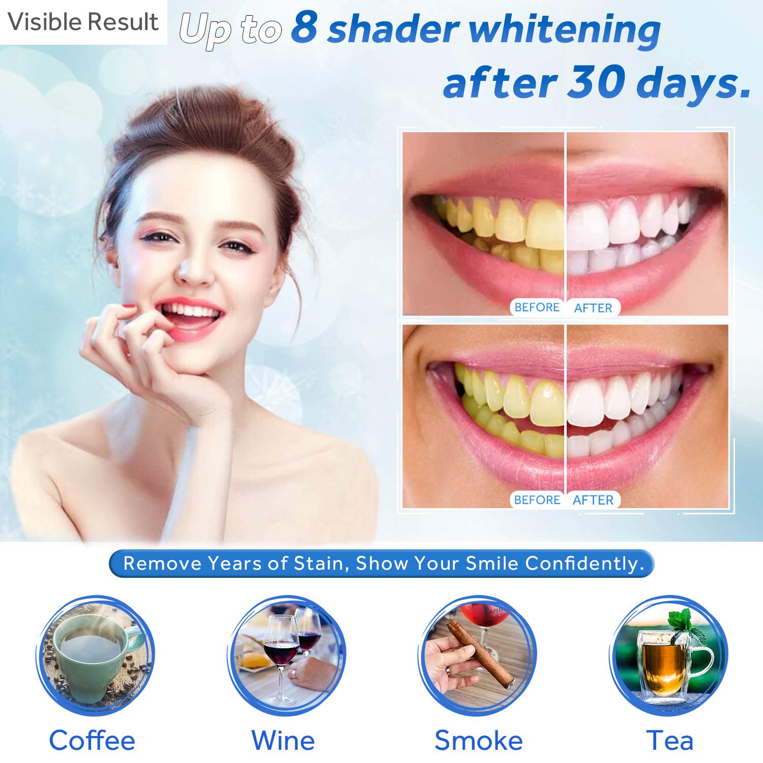 Tanden Whitening Gel Refill Sp - Teeth Whitening Results recensie en prijs