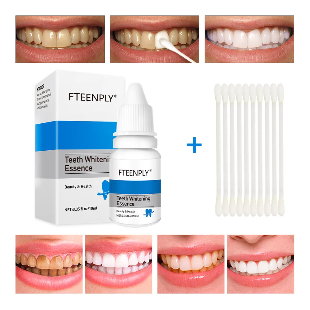 Fteenply Tanden Whitening Esse - Teeth Whitening Results recensie en prijs