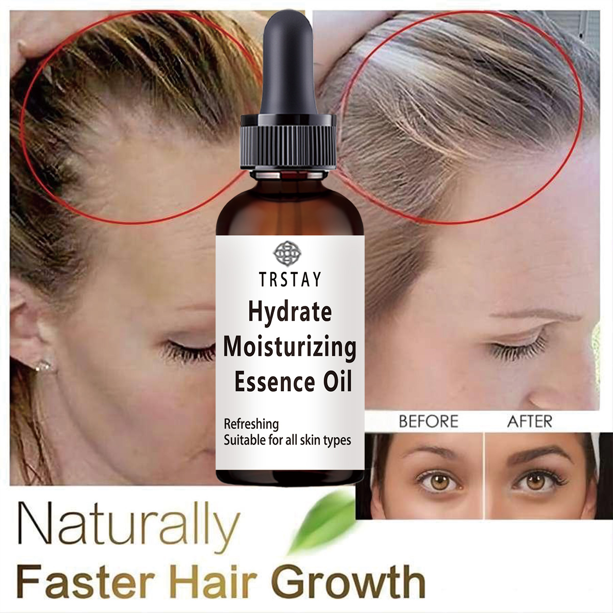 Nieuwe Ricinusolie Haargroei E - Coconut Oil Pull recensie en prijs