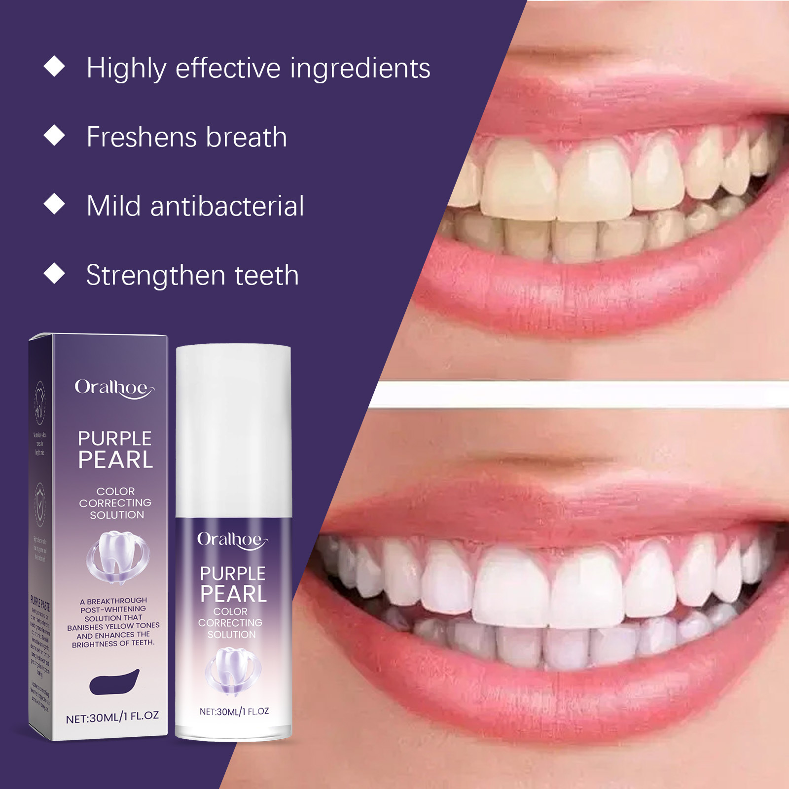 2026 Nieuwe Paarse Tandenbleek - Teeth Whitening Mousse recensie en prijs
