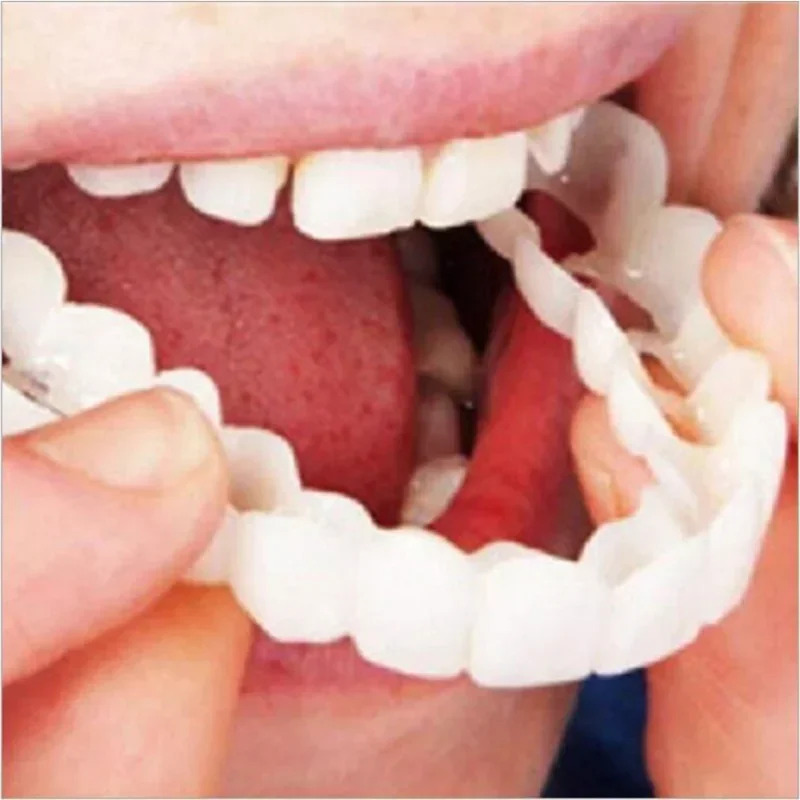 Perfect Fit Tanden Whitening V - Teeth Whitening Moulds recensie en prijs