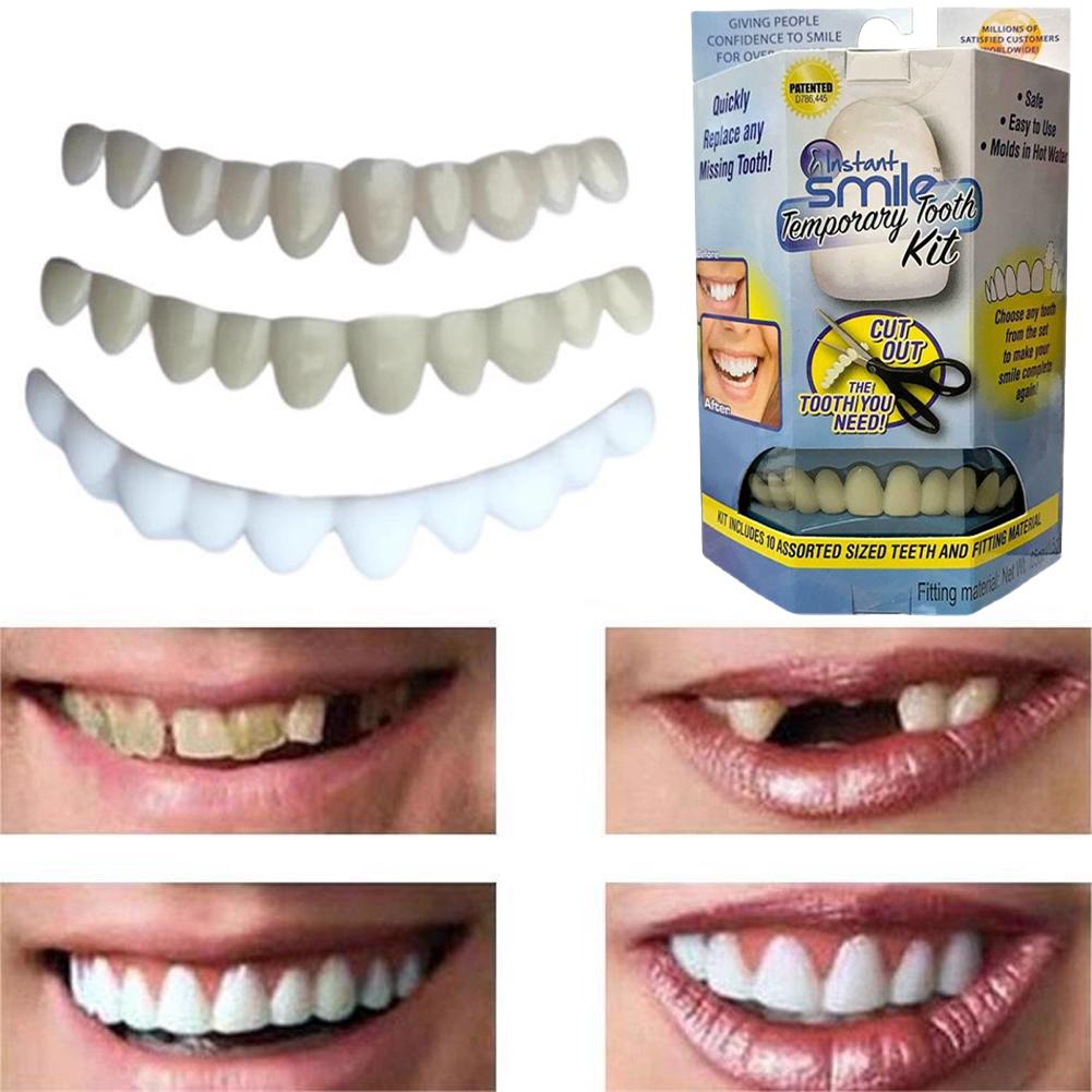 1 Kit Tandheelkundige Zorg Kun - Teeth Whitening Moulds recensie en prijs