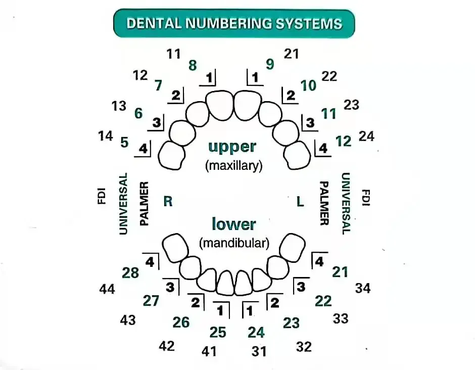 Tandheelkundige mal voor compo - Teeth Whitening Moulds recensie en prijs