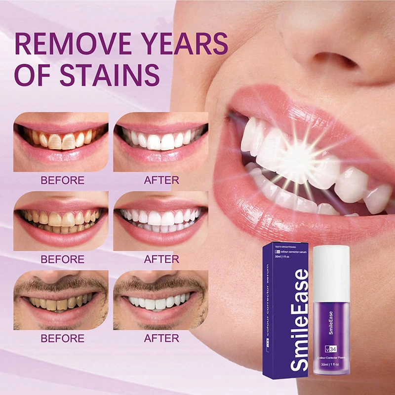 45ml Smilekit Paarse Tandmouss - Teeth Whitening Mousse recensie en prijs
