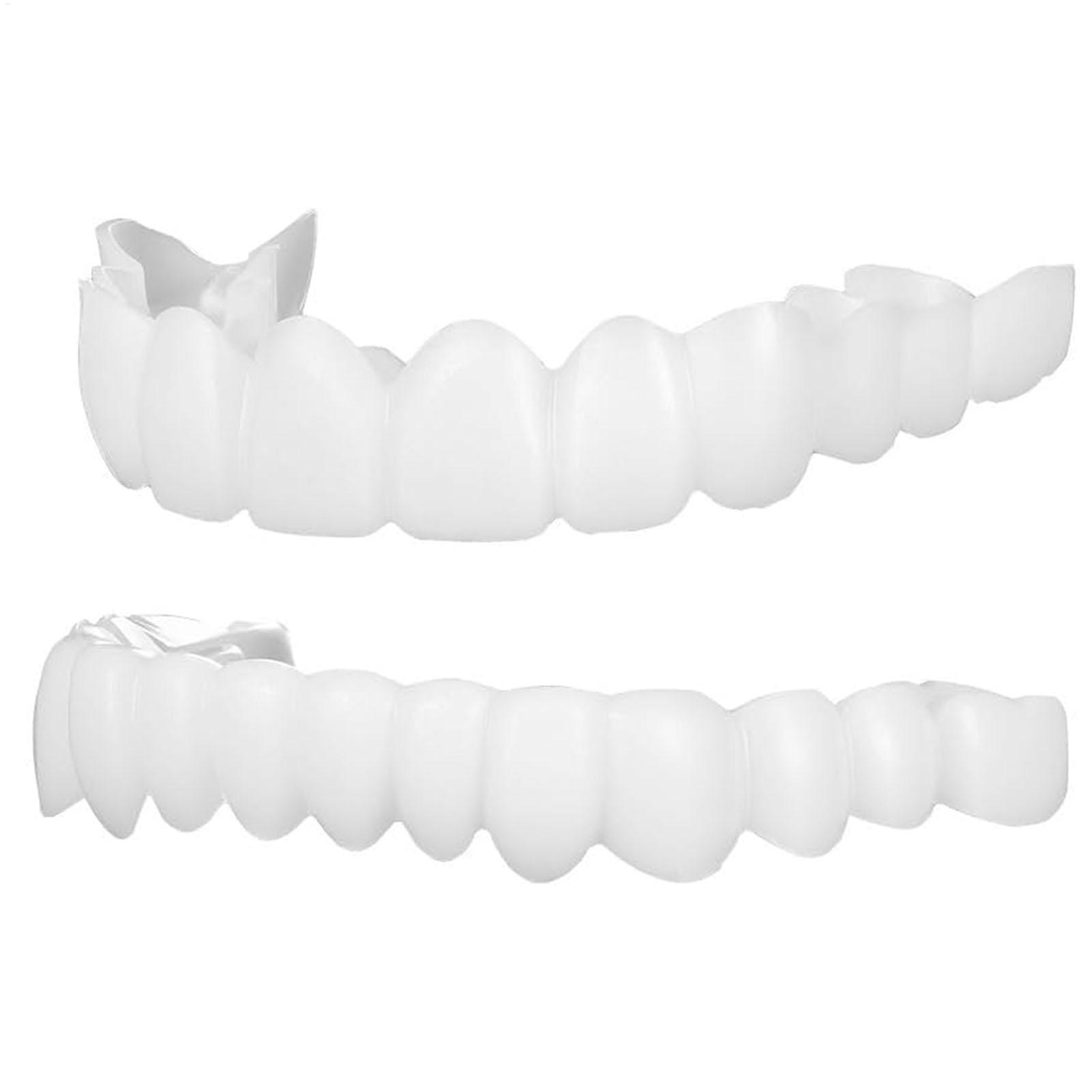 1 paar SnapsOn Tanden Facings  - Teeth Whitening Moulds recensie en prijs