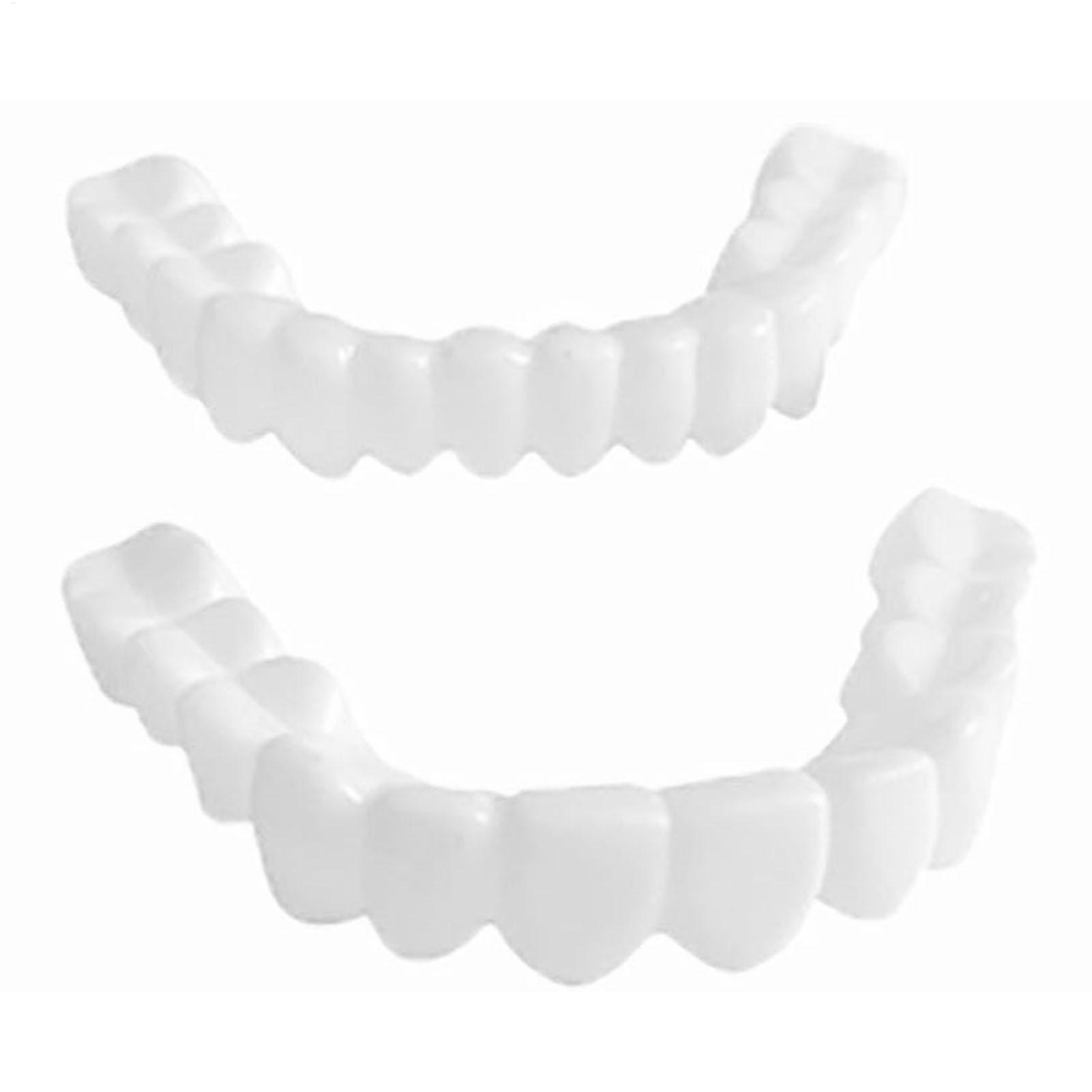 1 paar SnapsOn Tanden Facings  - Teeth Whitening Moulds recensie en prijs