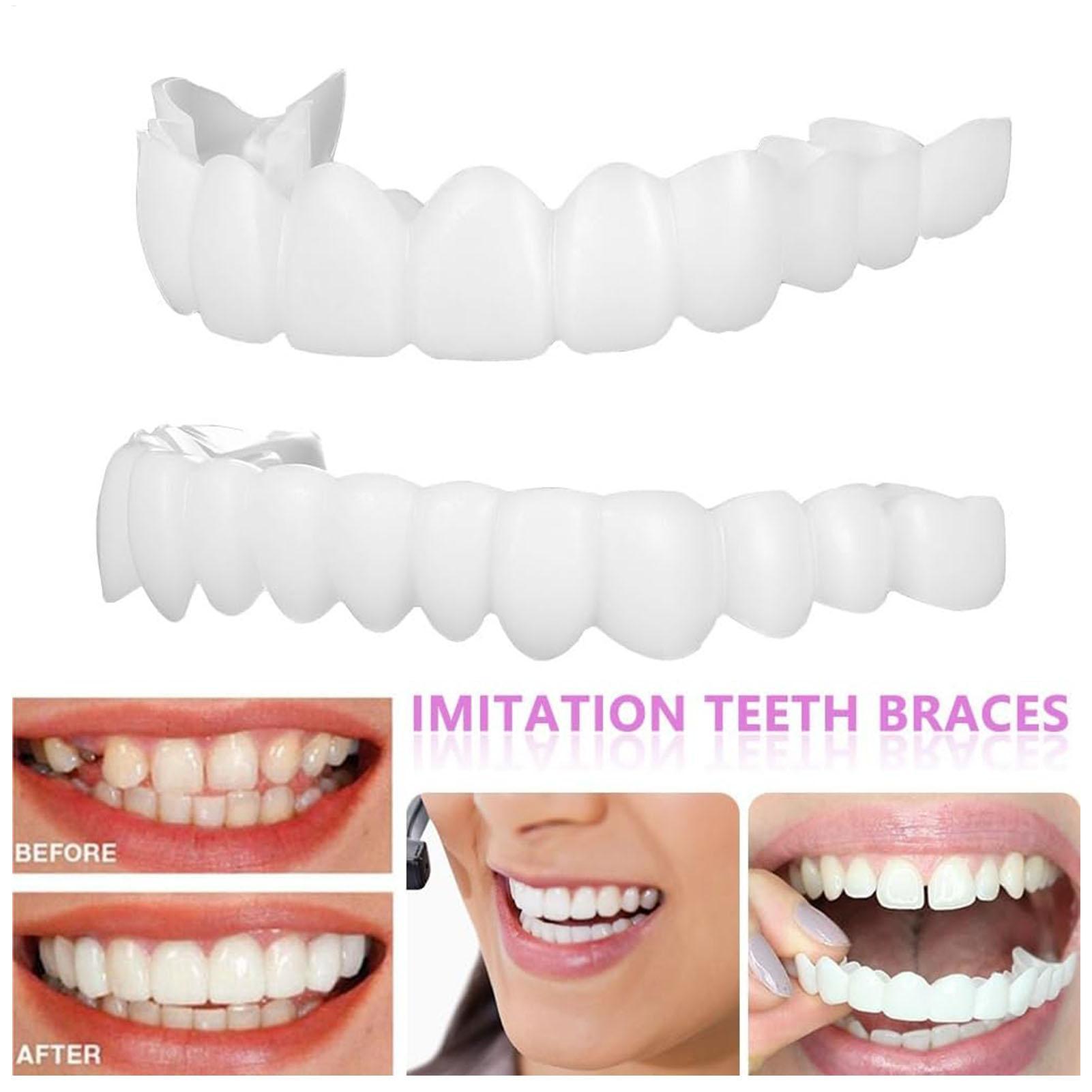 1 paar SnapsOn Tanden Facings  - Teeth Whitening Moulds recensie en prijs