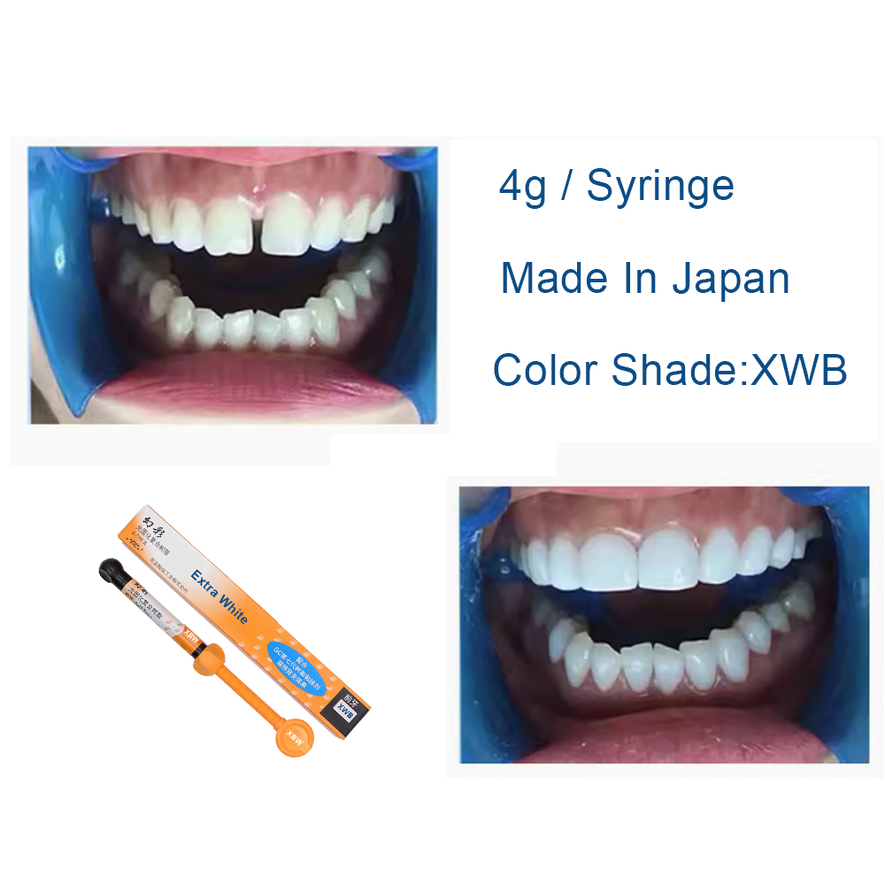 Tandheelkundige composiet hars - Teeth Whitening Professional recensie en prijs