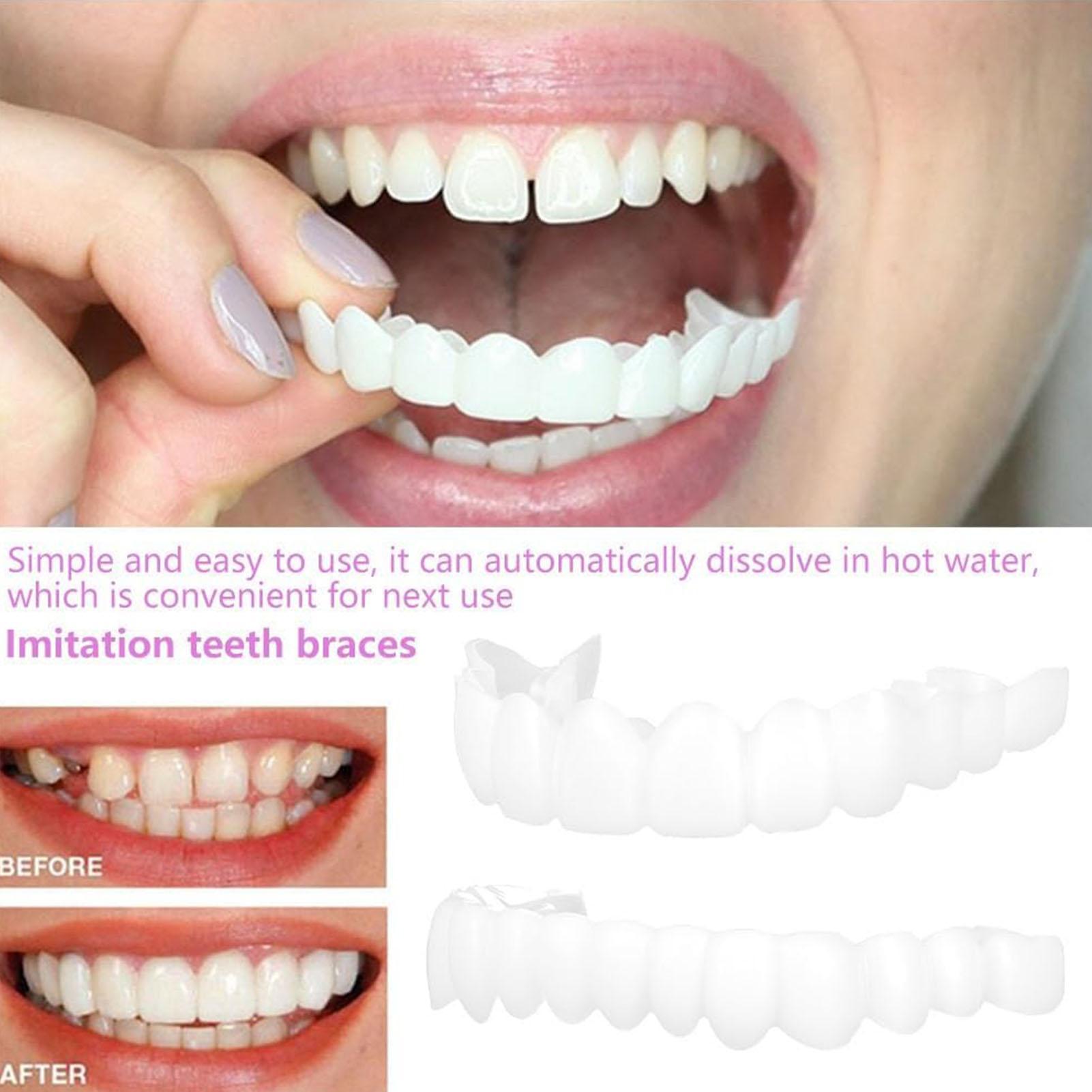 2 Stuks Mannen Vrouwen Tijdeli - Teeth Whitening Moulds recensie en prijs