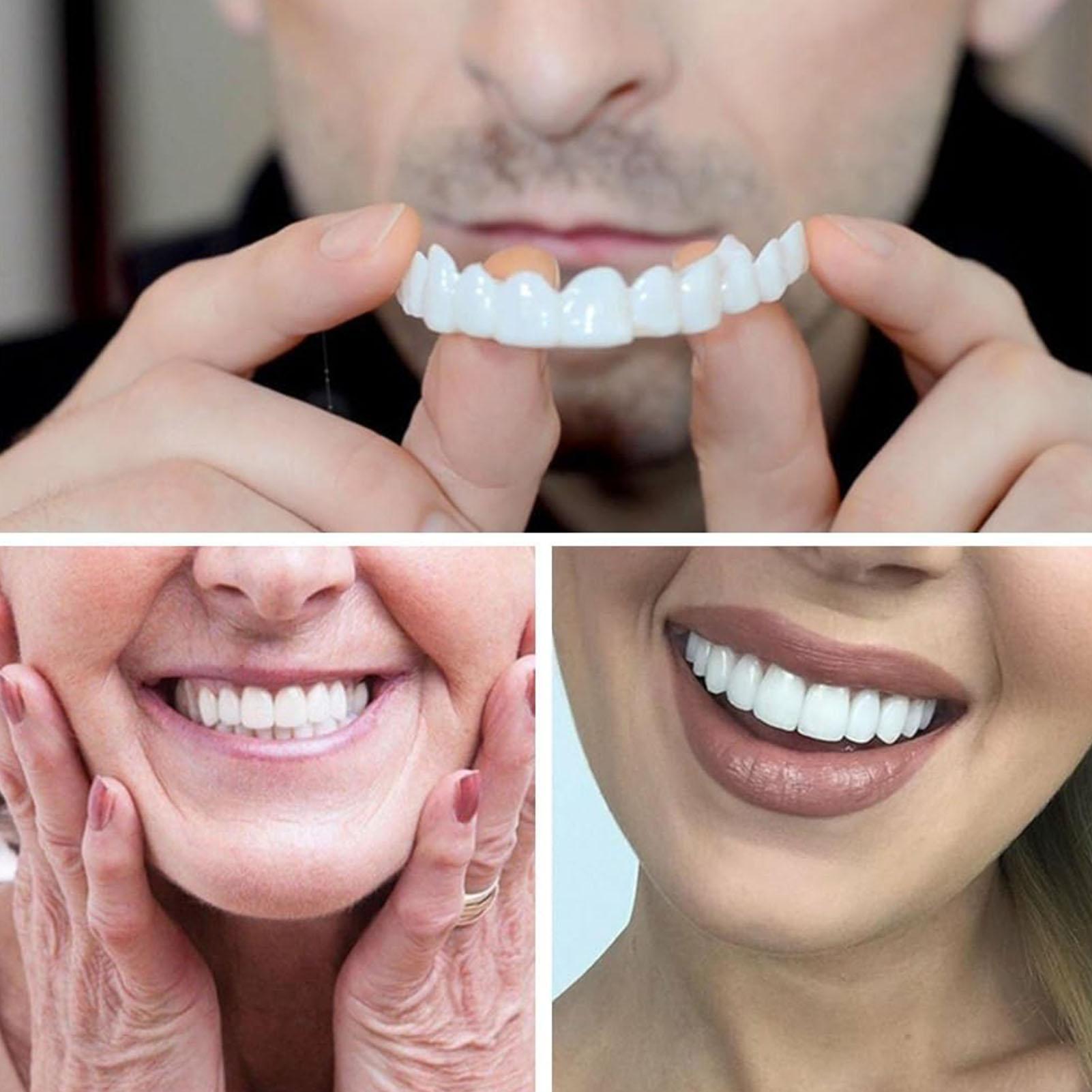 2 Stuks Mannen Vrouwen Tijdeli - Teeth Whitening Moulds recensie en prijs
