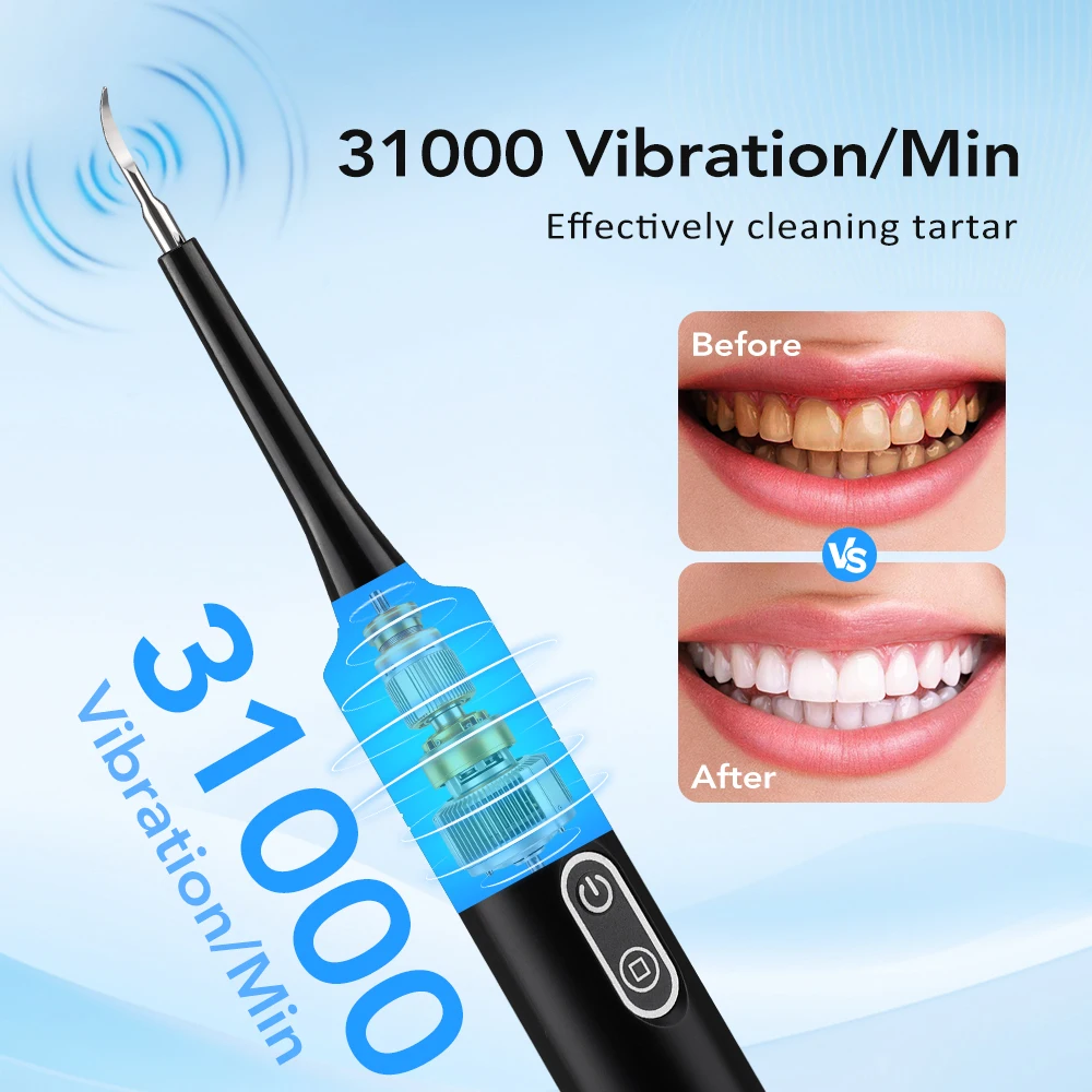 Elektrische sonische vibratie  - Electric Toothbrush Sonic recensie en prijs